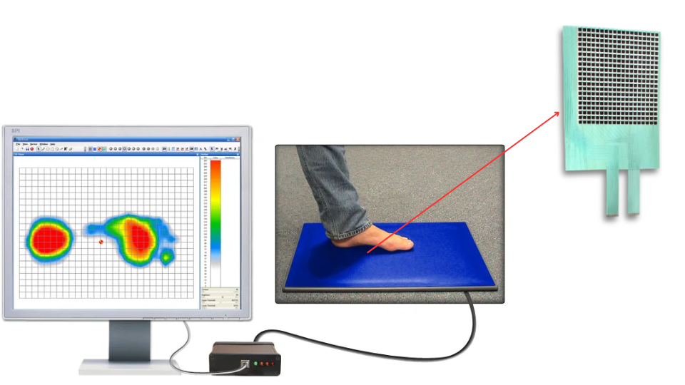 Matrix foot pressure sensor