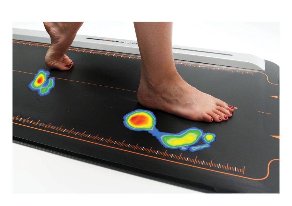Foot Pressure Analysis System